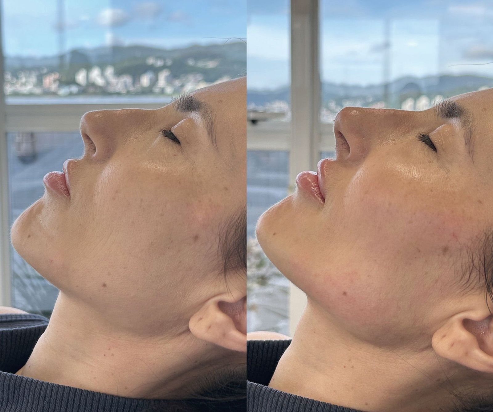 01-antes-depois