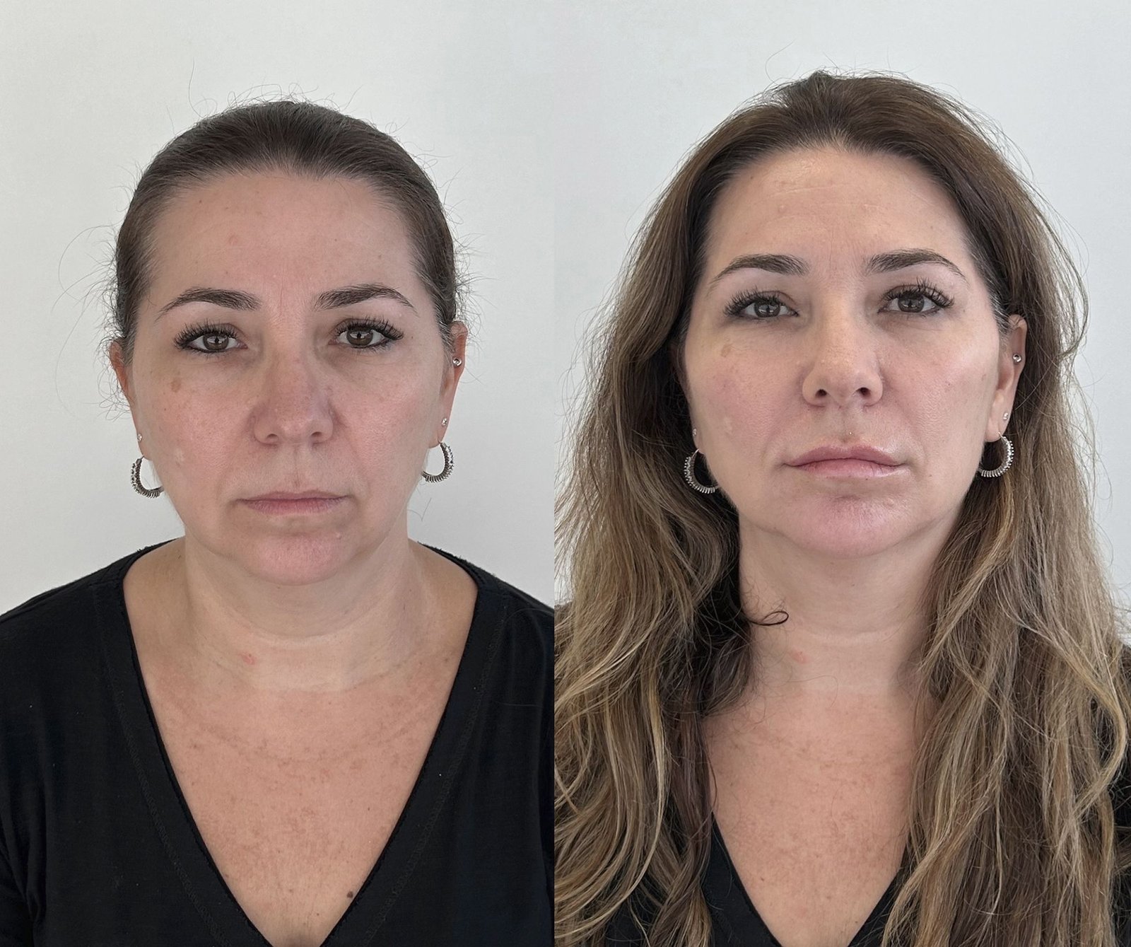 02-antes-depois
