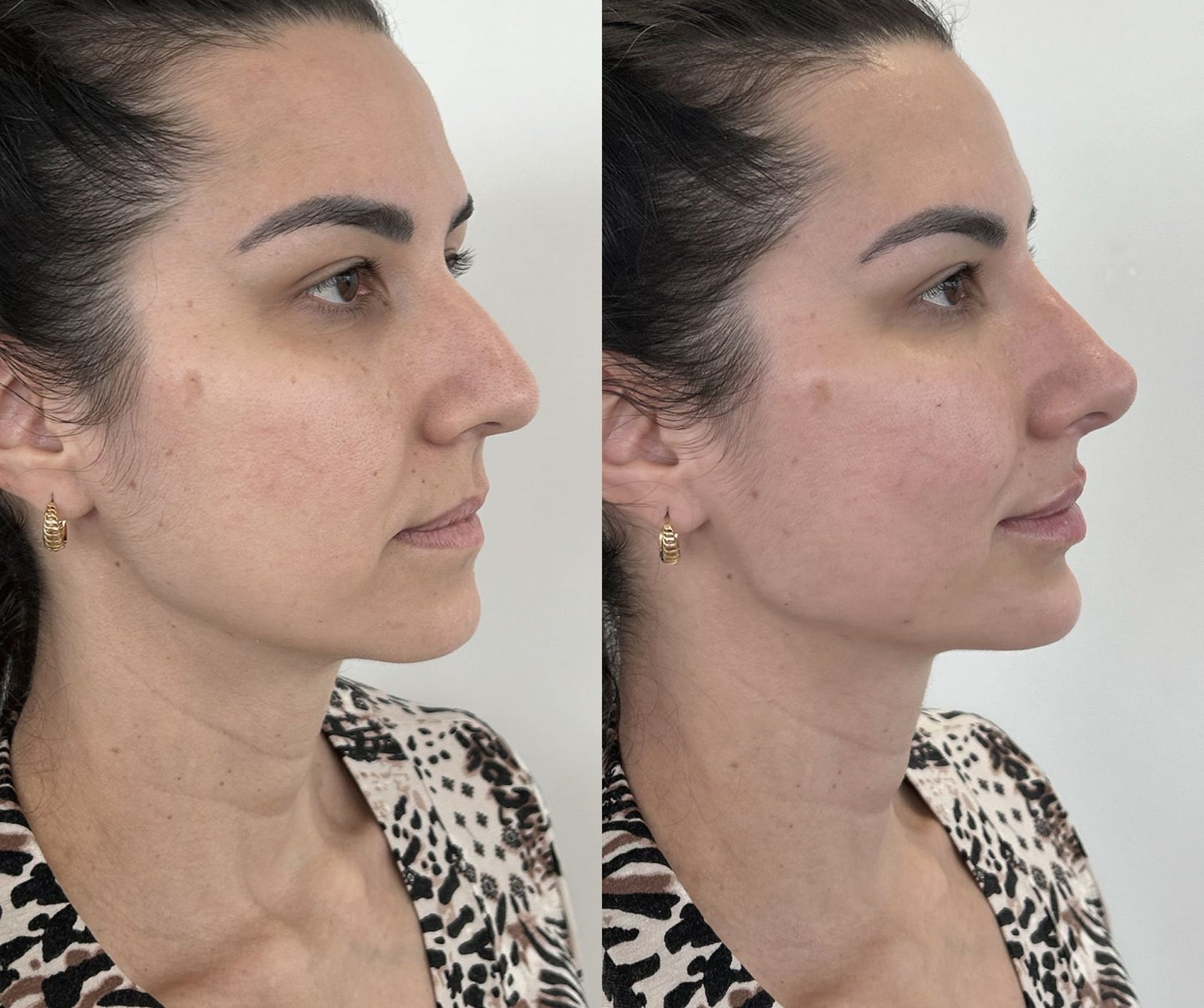 03-antes-depois