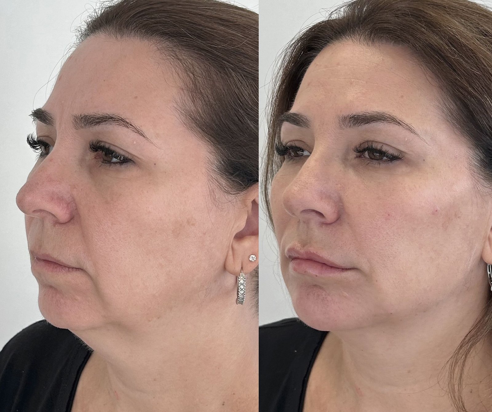 04-antes-depois