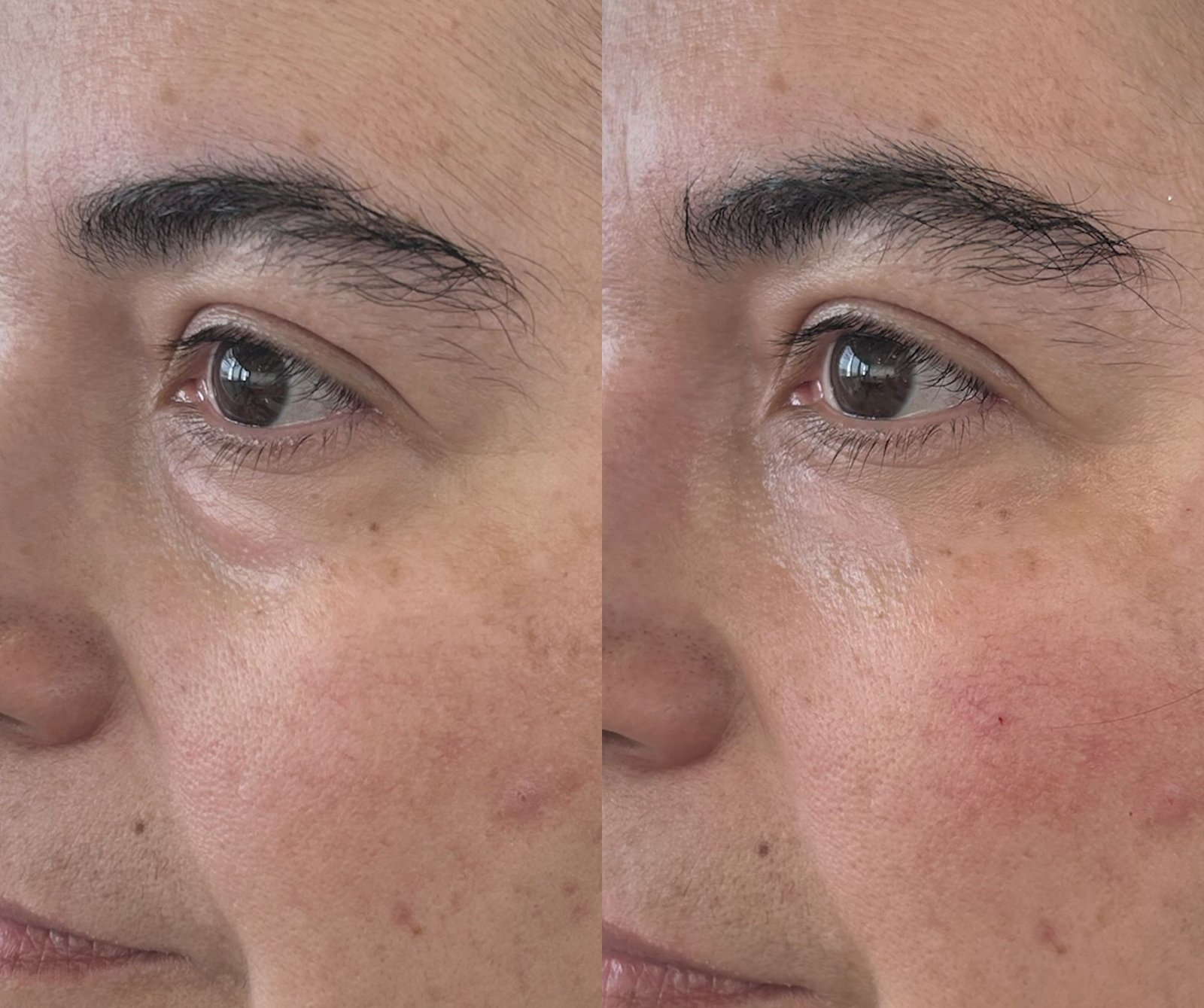 05-antes-depois