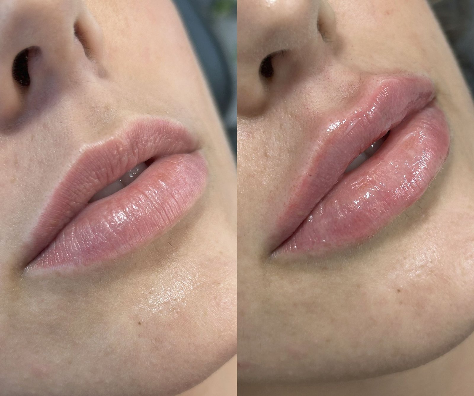 06-antes-depois